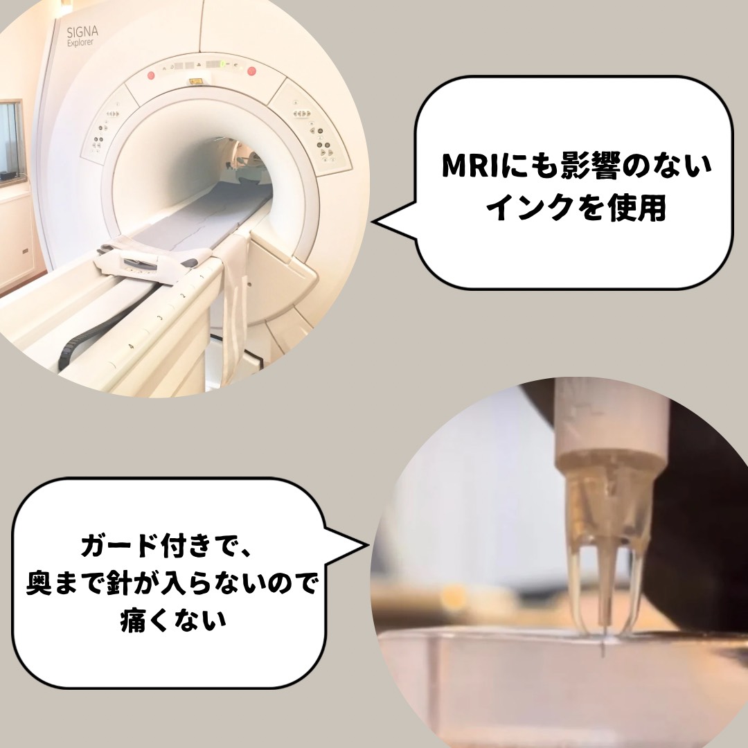 MRI検査OK