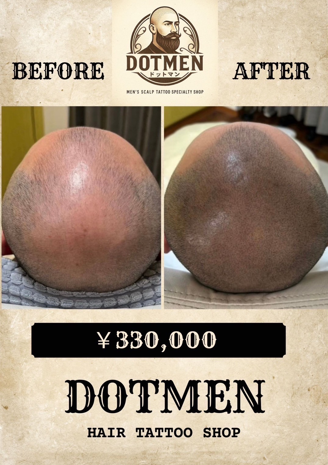 DOTMEN Case