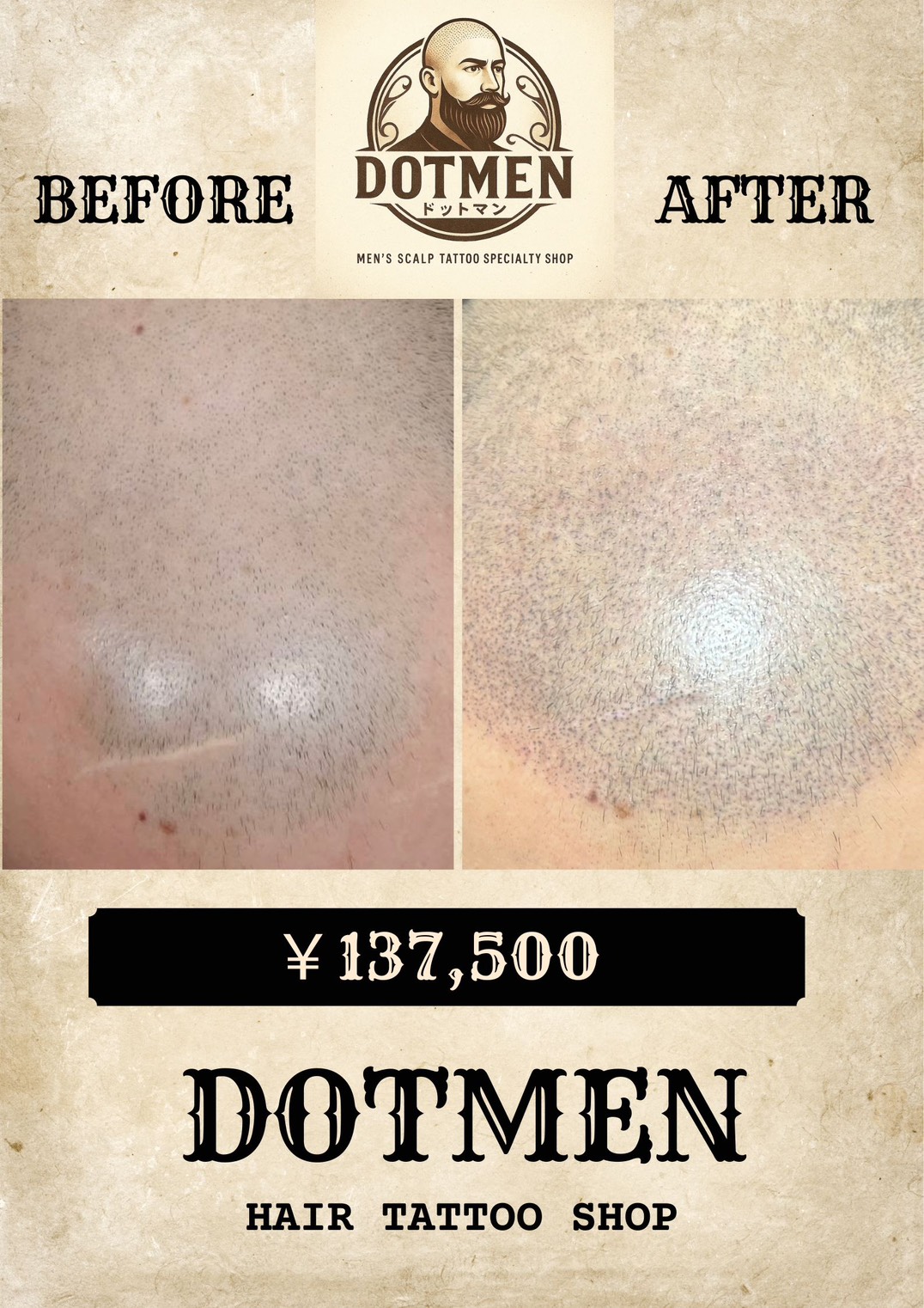 DOTMEN Case