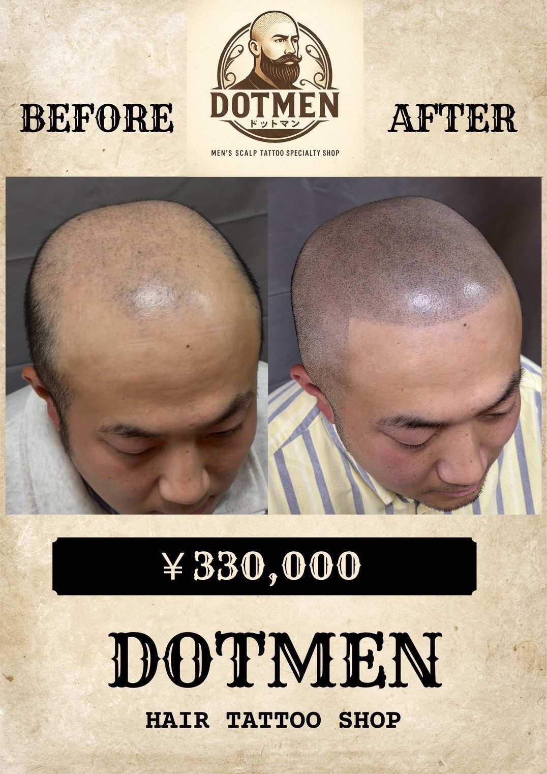 DOTMEN Case