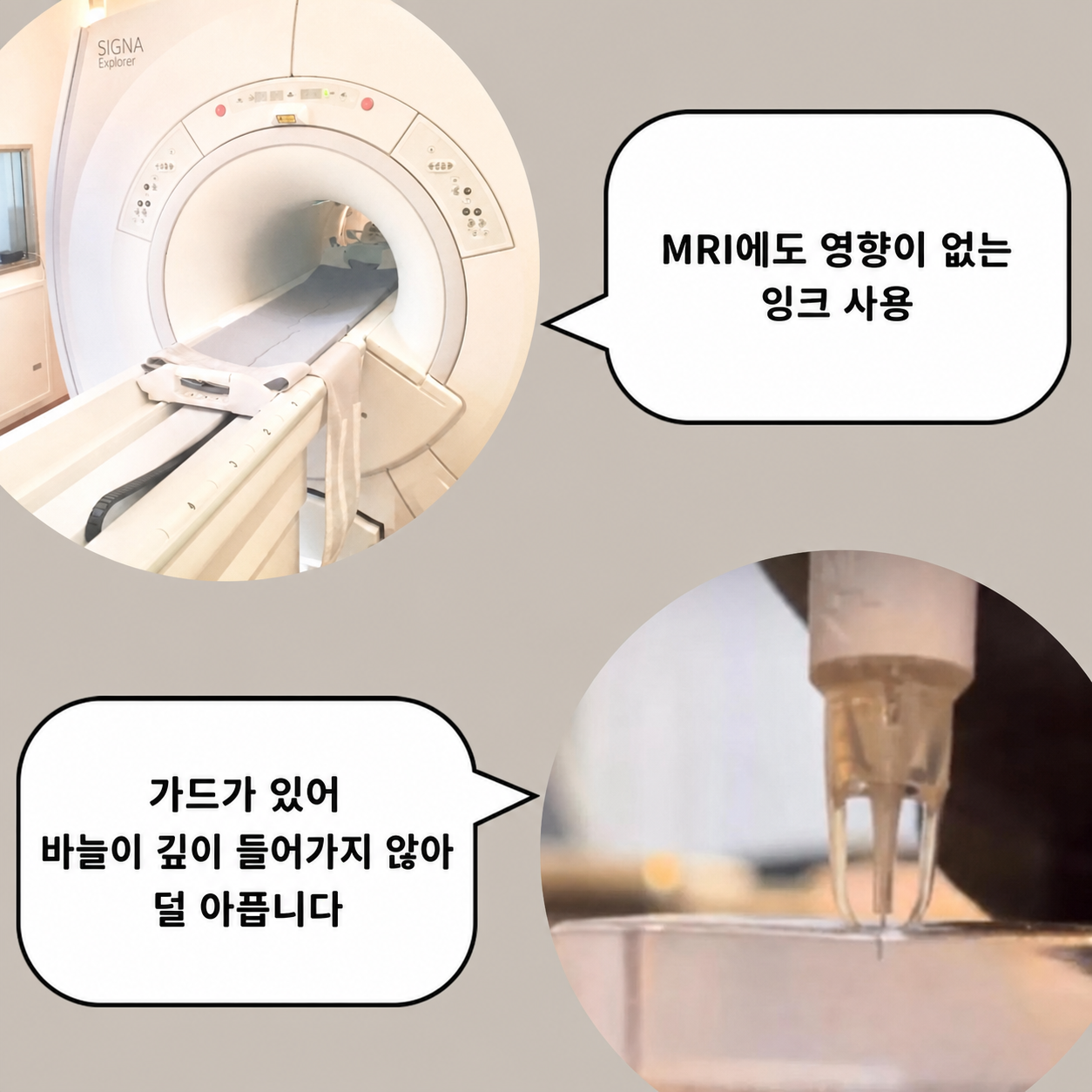 MRI 검사 가능