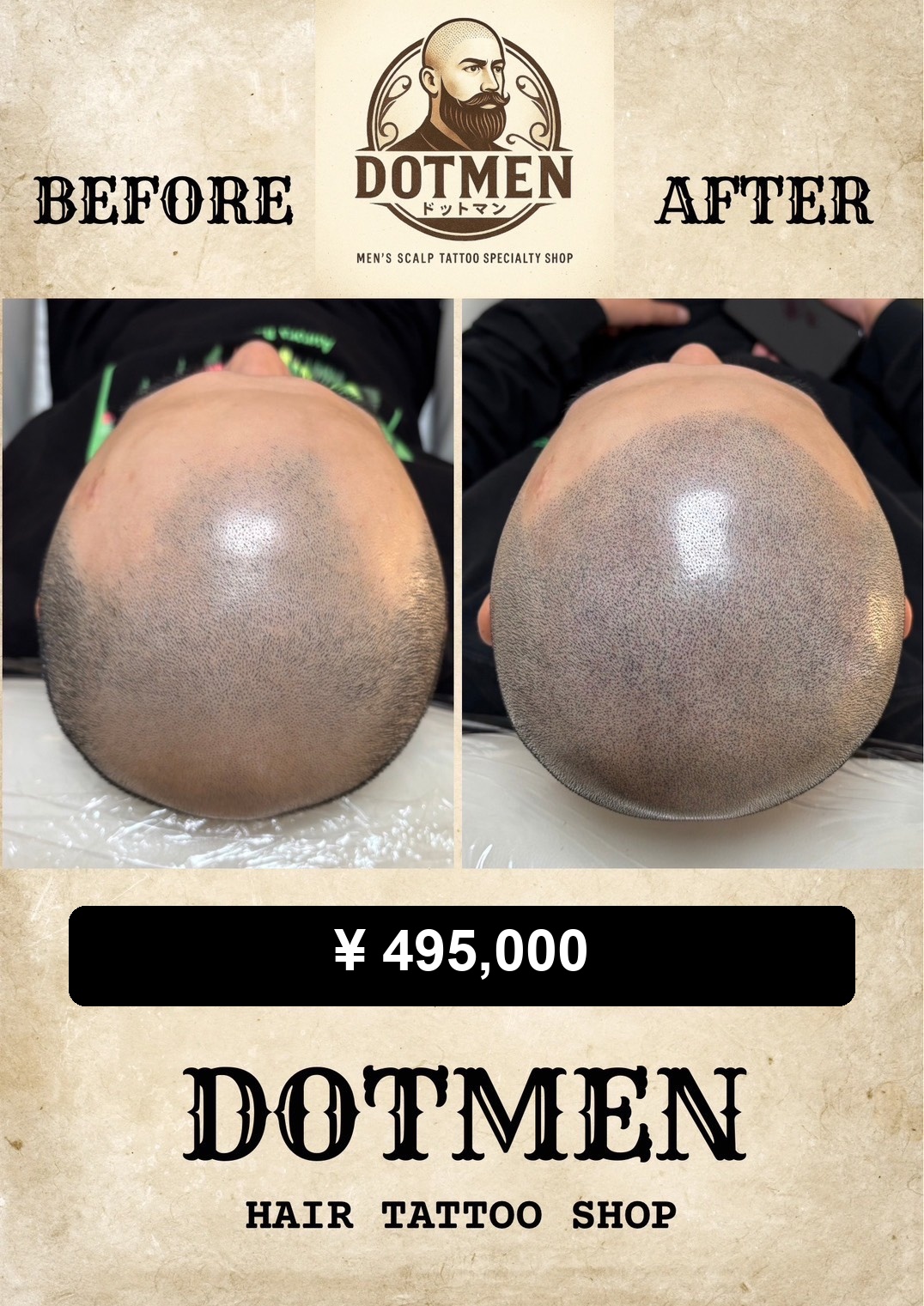 DOTMEN Case