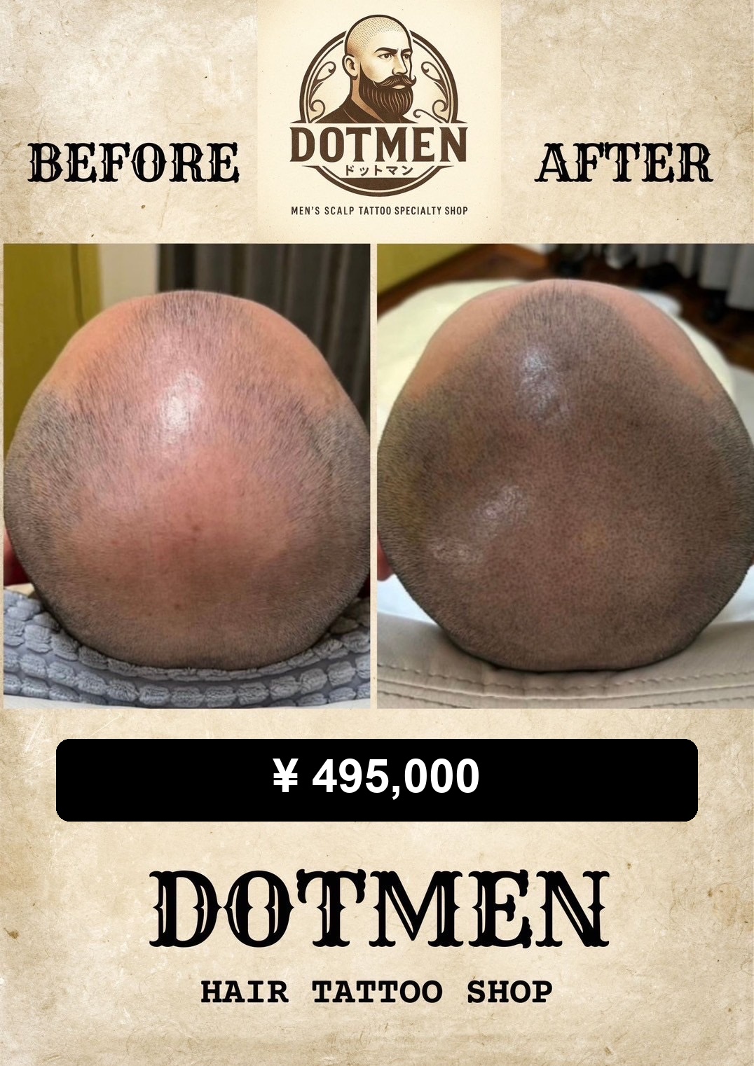DOTMEN Case