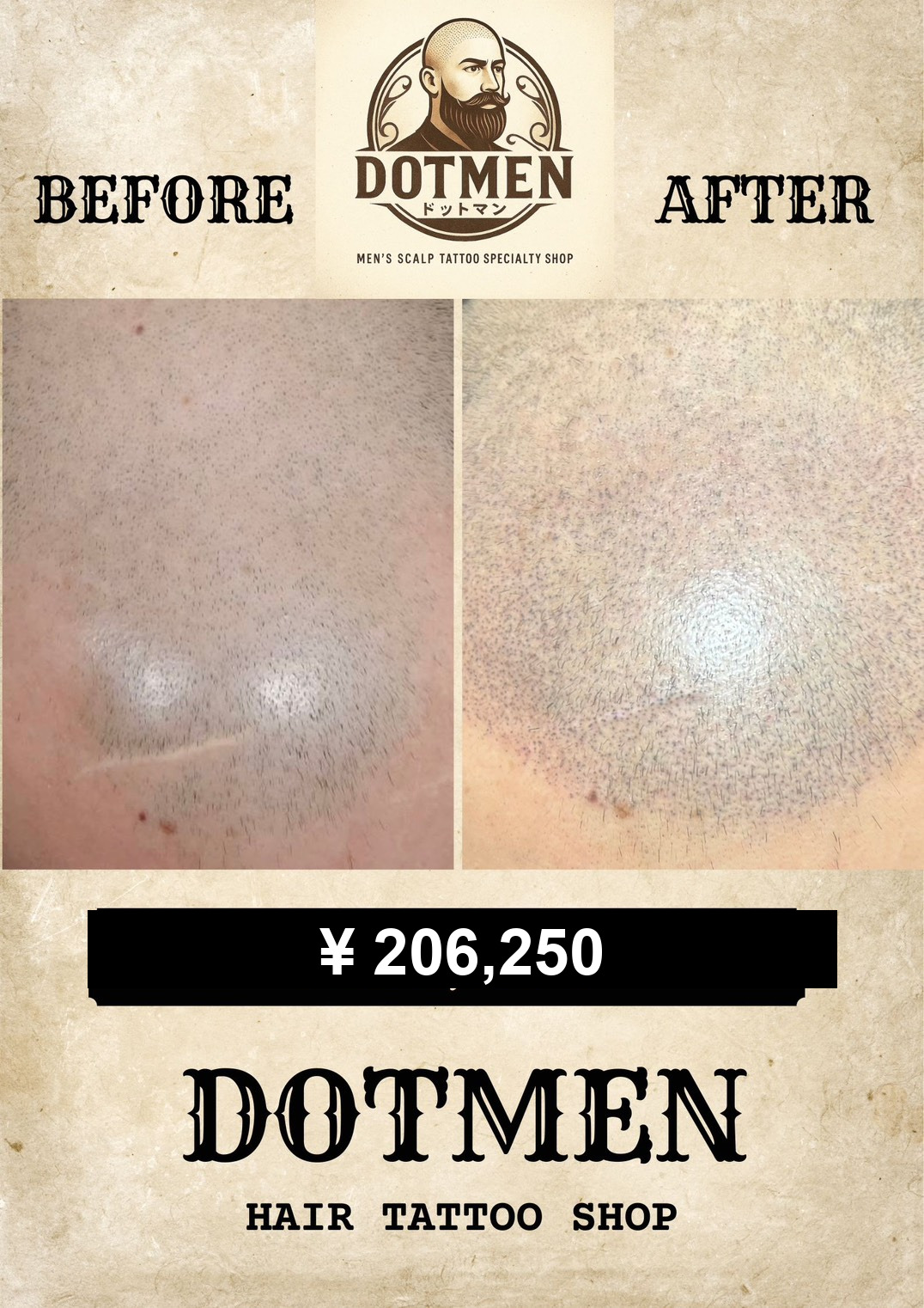DOTMEN Case