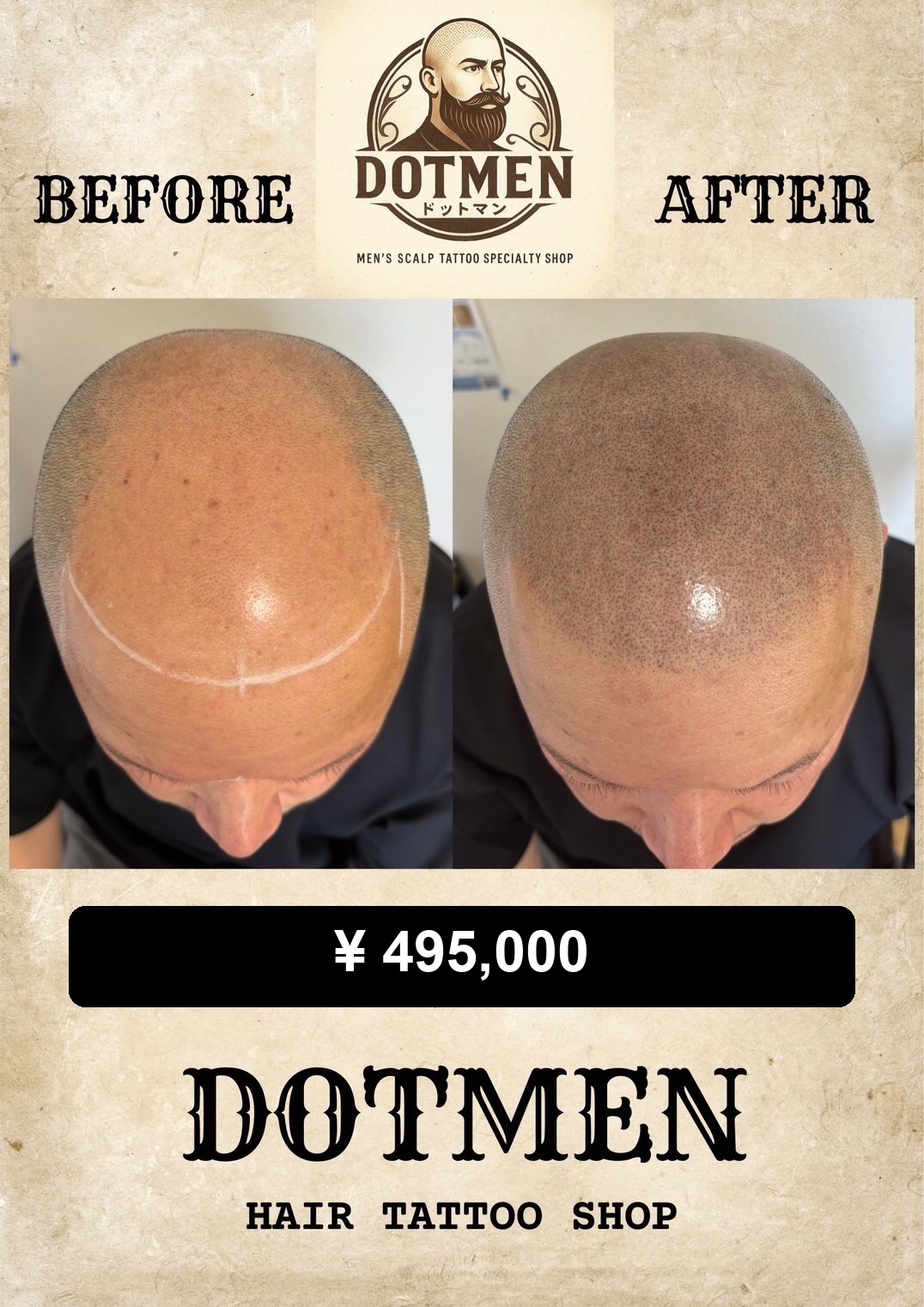 DOTMEN Case