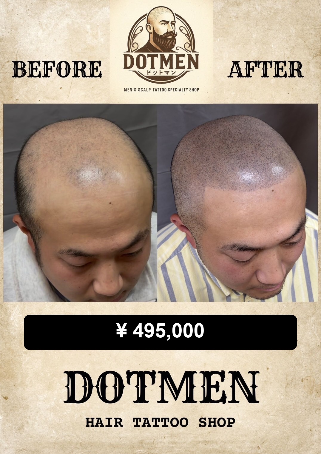 DOTMEN Case